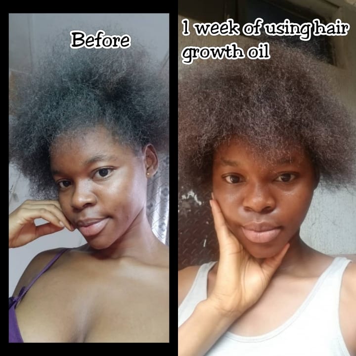 CUSTOMER REVIEW -- Hair Growth Oil