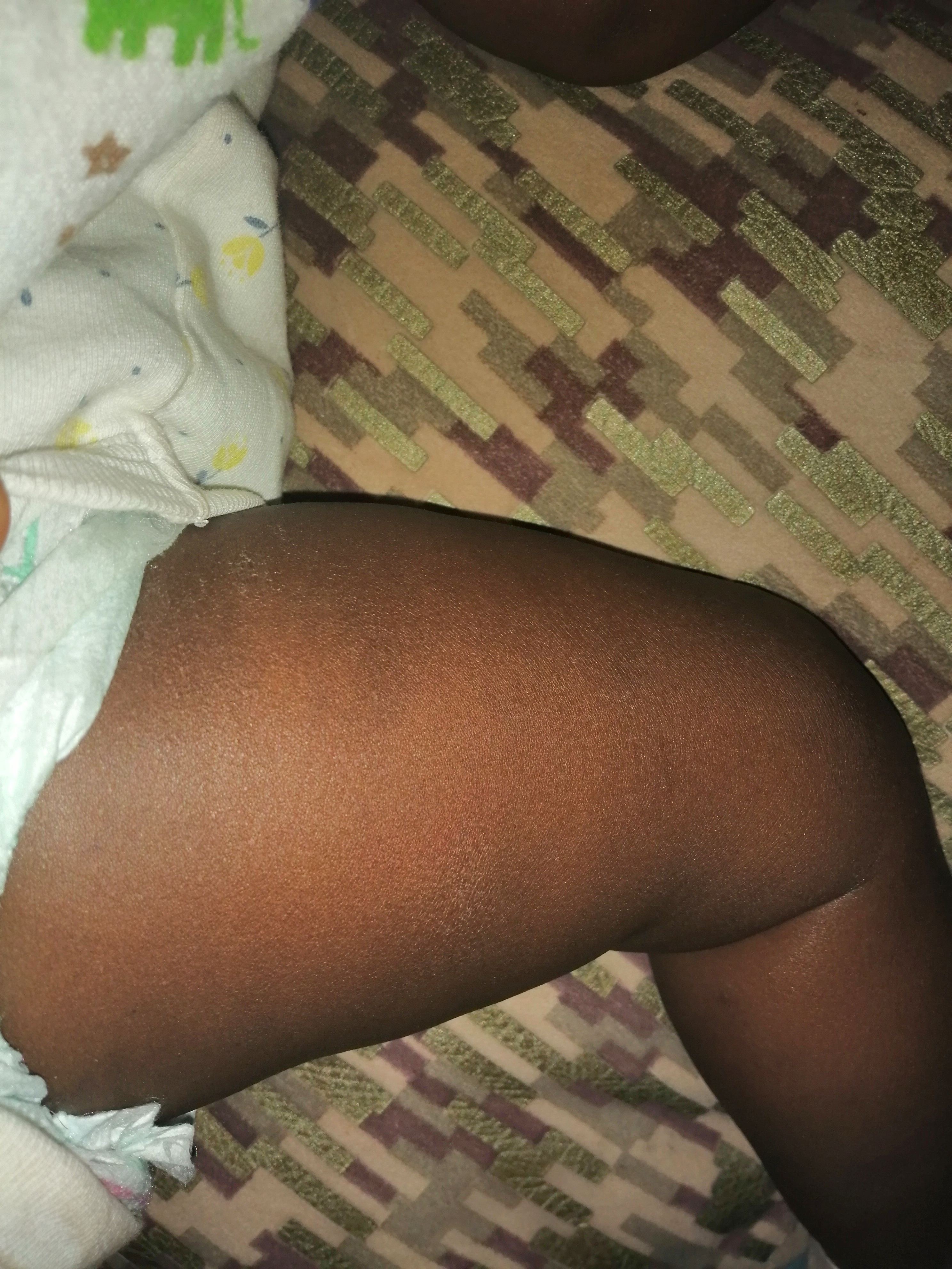 Childcare