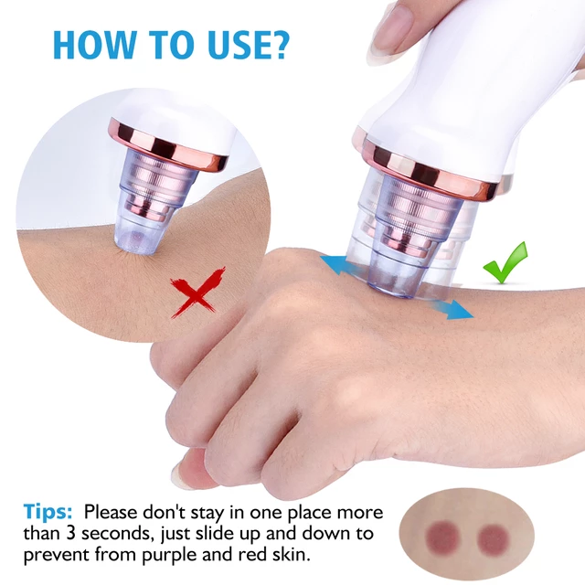 Face Vacuum pore cleaner Image